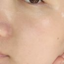 보람메디칼 이미지