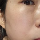 등마루하이퍼(등1) | 모발건강 판토모나 비오틴 하이퍼포머 섭취 후기
