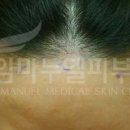 임마누엘헤어 네이버블로그