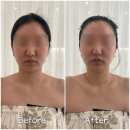 가경동 에스테틱 추천 더앤에스테틱 청주점, 얼굴 라인 정리와 데콜테까지 완벽!