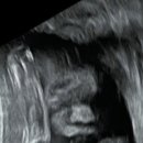 가연관악산부인과의원 이미지