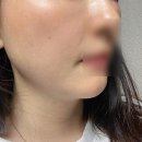 듀얼소닉 프로페셔널 후기 뷰티디바이스 1회 사용하고 탄력의 차이를 느꼈어요