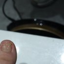 창원내성발톱 노퐁뷰티 내성발톱 관리후기