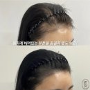 부산두피문신잘하는곳 시술 가격 후기!