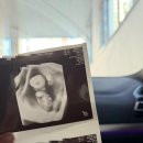 서울산부인과 | [육아정보]평택 서울유산부인과 다녀온 후기 산부인과 추천 이유