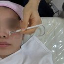유성피부관리 물톡스 물광관리 유성에스테틱 땡스윤 후기!