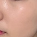 하이포레버 이미지