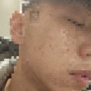 미체로의원 네이버블로그