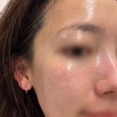 진갈매 | 갈매피부관리 구리에스테틱 아온에스테틱 폴카RF 얼굴케어 후기 (탄력 케어 추천)
