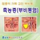 10월 12일(월) 오늘은 드디어 축농증 수술하는 날 이미지