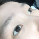 까진속눈썹