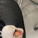 제민정형외과의원 | 노원 내향성발톱(내성발톱) 수술 후기