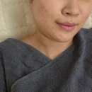 군산트러블관리 | 여드름 압출후기 | 군산에스테틱 감동스킨앤네일 군산점