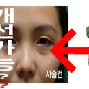 다크서클에 좋은 음식 :: 눈밑에 다크서클 원인 무엇일지 살펴보자 이미지