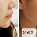 뷰티라인 이미지