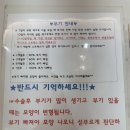 코야네일 | 대구 코수술 내돈내산 후기 #1 : 상담~2일차 기록