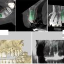 연 치과기공소 이미지