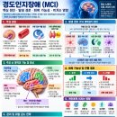 《뇌 건강 효율적 관리법》 경도인지장애 예방 이미지