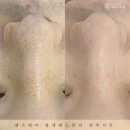 봄에스테틱 이미지