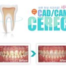좋은날치과기공소 이미지