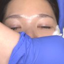 Phase(페이즈) | 대구 편평사마귀,비립종 얼굴요철관리 피부결 케어 페이즈(Phase) 스킨케어 솔직후기