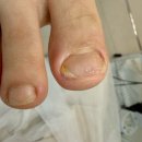 다시온 리케어 이미지