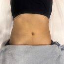 골드라인공인중개사사무소 | [범계 에스테틱] 피어라인 복부 순환 관리로 묵은 붓기 싹 빼고 온 후기!