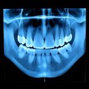 이엘메디컬 | 잇몸이 자꾸 킹받아서 냅다 달려간 썰 푼다