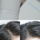 두피괄사 덕분에 두피 각질 고민 해결 다노날 탈모앰플 한달 후기