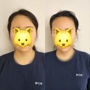 해운대에스테틱 얼굴관리 1년 결이고은