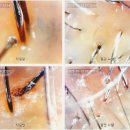 모팔 | 안산두피관리 모앤두피탈모 안산고잔점 솔직후기 | 두피가려움증·탈모 고민 체험담