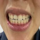 마일스톤즈치과의원 이미지