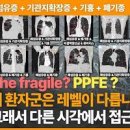 폐섬유증 증상과 원인, 특발성 폐섬유증 치료 까지 정리 이미지