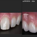 디자인탑치과기공소 이미지