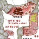 장청뇌청