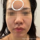 피오니 스킨 앤 바디 이미지