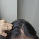 지핸케어 | 탈모관리 앰플 셀케어헤어부스터 2주사용후기 전후차이비교