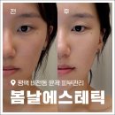 씨유평택비전골든점 | 평택피부관리 작은 얼굴 윤곽관리 &#39;봄날에스테틱&#39; 써마지 플라즈마 솔직후기