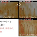 스타링