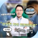 청우빌딩 | 부산 연산동 임플란트, 상실된 치아 어떻게 회복할까요?