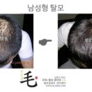 불로장생모