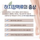 (하지정맥류 수술후 주의사항 '운동') 이미지