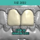 유성치과기공소 이미지