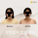 목 짧은 사람 인생 바꾼 경락마사지 지금 필요한 건 몸의 리셋