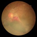 유망안과의원 이미지