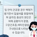 혀 갈라짐 증상 및 원인과 치료 : 혓바닥 갈라짐 이미지