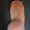 수약품 | (※극혐주의※)한미약품 유리아크림 발각질제거해보잣!(보름 사용 후기)