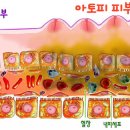 아토피의 원인과 치료법 이미지