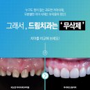 보일치과기공 네이버블로그