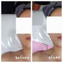 여우미헤어 | 수유피부관리 리프팅 데콜테 목관리 여우미스킨케어 에스테틱 솔직 후기